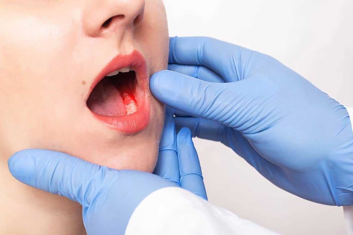 7 Ways to Stay Protected Against Gum Diseases