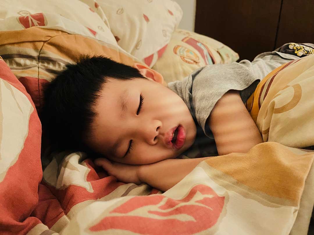 7 Signs Your Child May Need an Airway Assessment (And It's Not Just Snoring!)